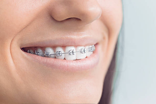 Best Root Canal Treatment  in Parkland, FL